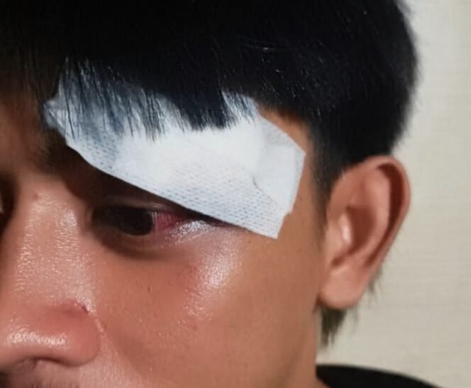
					Aniaya Warga Sampai Luka, Lurah Tomoni Jalani Proses Hukum Di Polsek Mangkutana